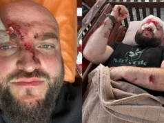 Поліція встановлює причетних до побиття ветерана АТО у Затоці через російську музику Поліція встановлює причетних до побиття ветерана АТО у Затоці через російську музику