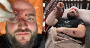 Поліція встановлює причетних до побиття ветерана АТО у Затоці через російську музику Поліція встановлює причетних до побиття ветерана АТО у Затоці через російську музику