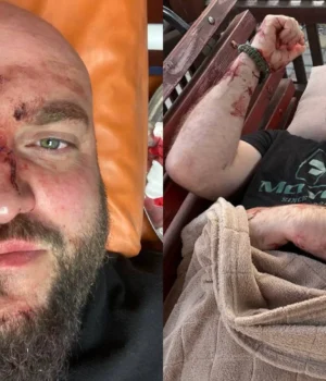 Поліція встановлює причетних до побиття ветерана АТО у Затоці через російську музику