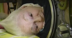 Померла остання американка, яка все життя дихала за допомогою “залізних легень” після поліомієліту Померла-остання-американка,-яка-все-життя-дихала-за-допомогою-“залізних-легень”-після-поліомієліту