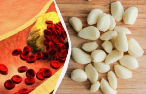 Що буде з холестерином, якщо їсти більше часнику: названо 5 можливих ефектів Що-буде-з-холестерином,-якщо-їсти-більше-часнику:-названо-5-можливих-ефектів