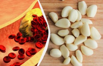 Що буде з холестерином, якщо їсти більше часнику: названо 5 можливих ефектів Що-буде-з-холестерином,-якщо-їсти-більше-часнику:-названо-5-можливих-ефектів