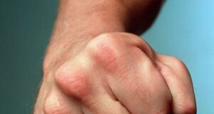 Бійка у ліцеї Кривого Рогу закінчилася лікарнею: що сталося з підлітками Бійка-у ліцеї-Кривого-Рогу-закінчилася-лікарнею:-що сталося-з підлітками