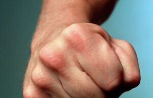 Бійка у ліцеї Кривого Рогу закінчилася лікарнею: що сталося з підлітками Бійка-у ліцеї-Кривого-Рогу-закінчилася-лікарнею:-що сталося-з підлітками