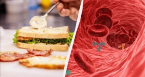 Кардіологи назвали популярну приправу, яка може непомітно закупорювати судини Кардіологи-назвали-популярну-приправу,-яка-може-непомітно-закупорювати-судини