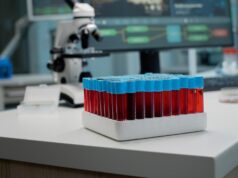 Як підготуватися до біохімії крові, щоб результати були максимально точними Як-підготуватися-до-біохімії-крові,-щоб-результати-були-максимально-точними