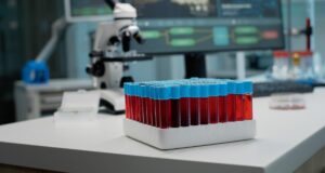 Як підготуватися до біохімії крові, щоб результати були максимально точними Як-підготуватися-до-біохімії-крові,-щоб-результати-були-максимально-точними