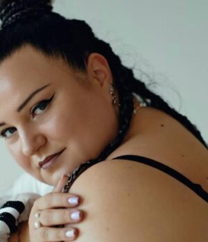 alyona-alyona-показала-живіт-після-операції-зі-зменшення-шлунку alyona-alyona-показала-живіт-після-операції-зі-зменшення-шлунку